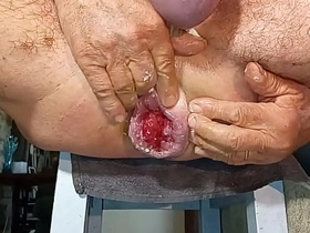 扩肛侠2025-14 asian uncle gay sex videos twitter