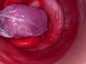 深入阴道的摄像头记录下带着套套的巨量射精 best gay sex porn videos asian